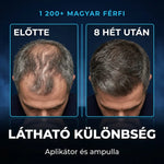HajLabs — A hajnövesztés új generációja 8