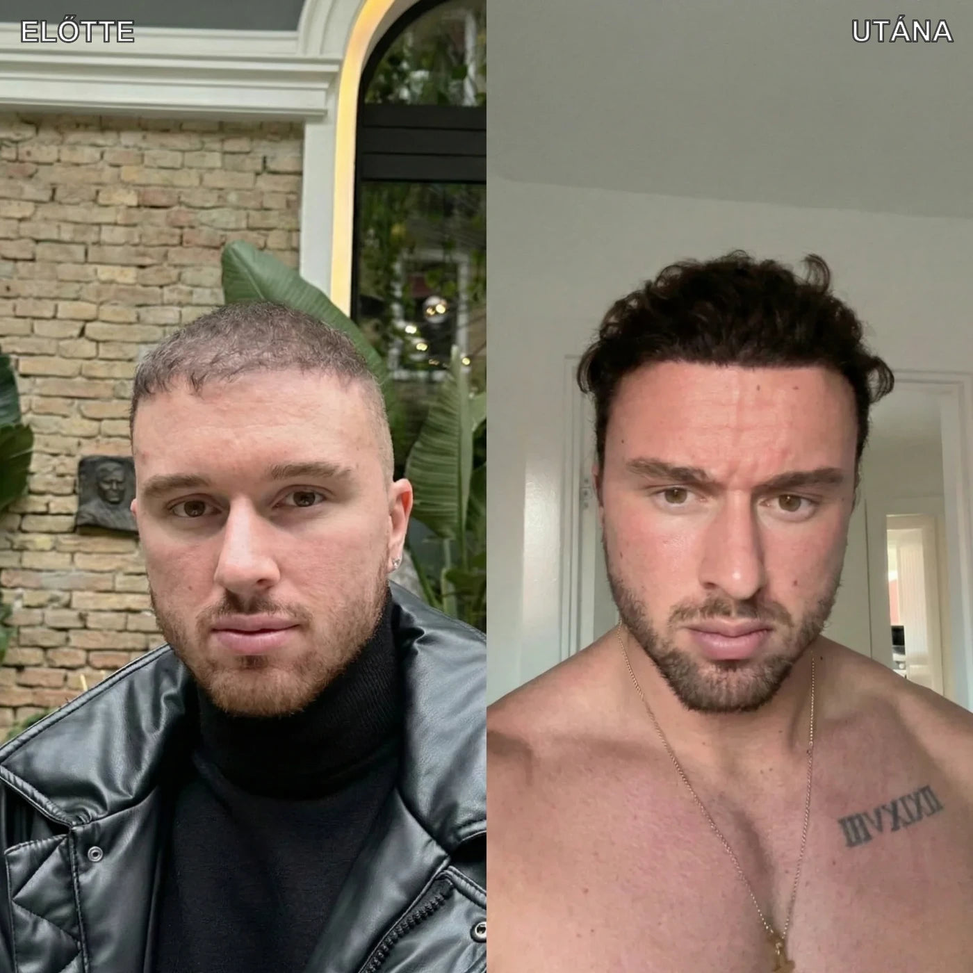 Hajlabs előtte és utána 1