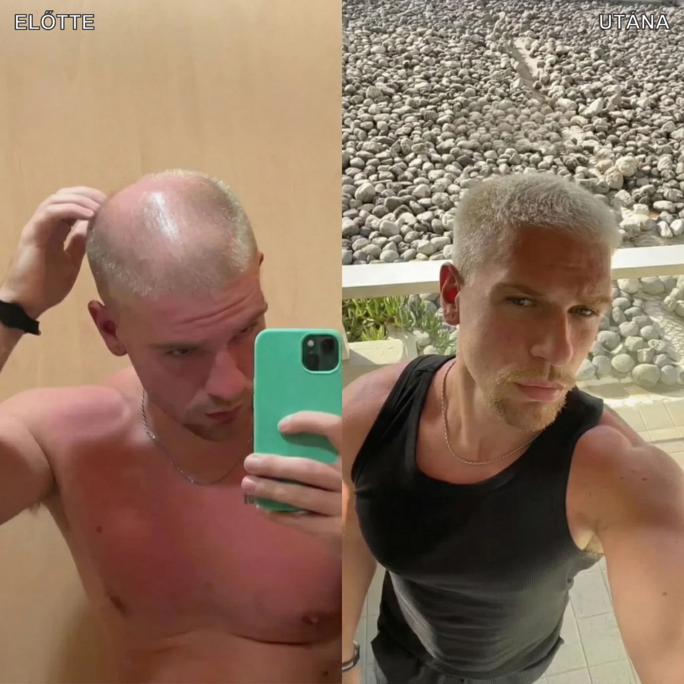Hajlabs előtte és utána 2