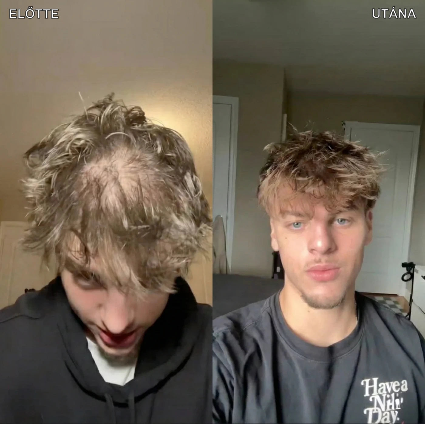 Hajlabs előtte és utána 3